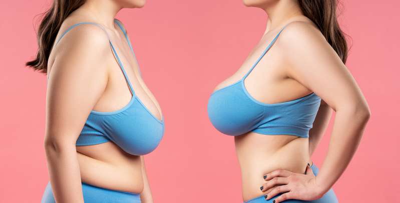 Schon im Teenageralter wird die spätere Form der Brüste erkennbar und teilweise zeigt sich, dass das Mädchen als Frau Hängebrüste haben wird. ( Lizenzdoku: Shutterstock- staras )